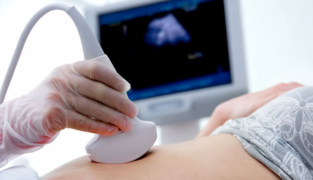 Законопроект «о сердцебиении зародыша» рассматривают во Флориде. На фото УЗИ беременной