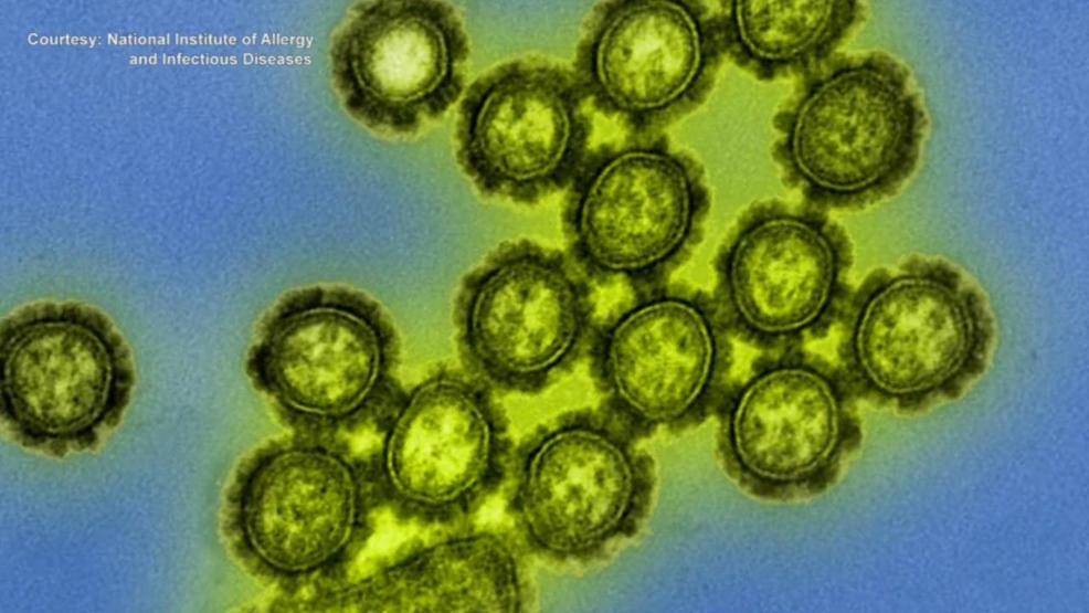 Вакцина от гриппа в этом году эффективна лишь на 50%. На фотографии вирус под микроскопом