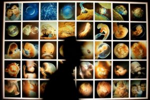 В доме гинеколога из Индианы нашли тысячи эмбрионов. На фото несколько эмбрионов